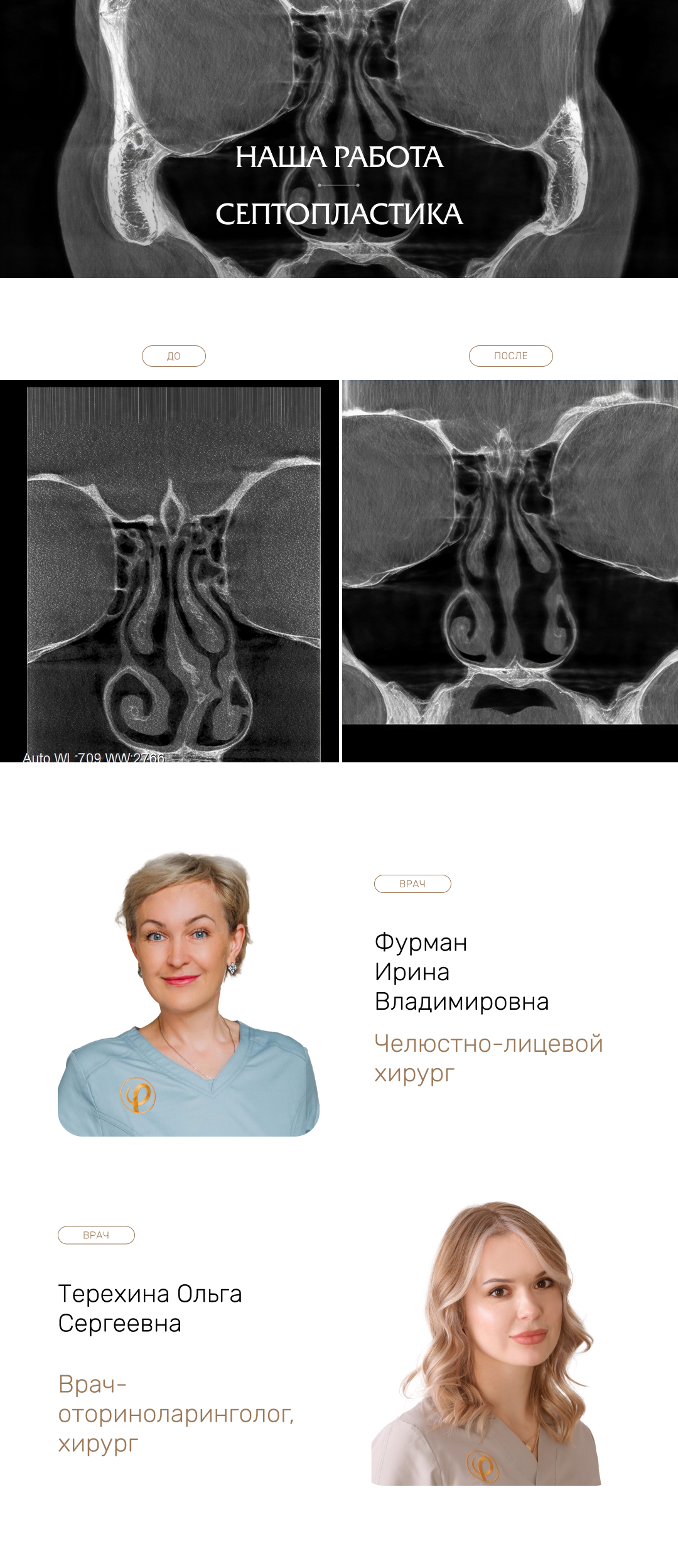 Септопластика